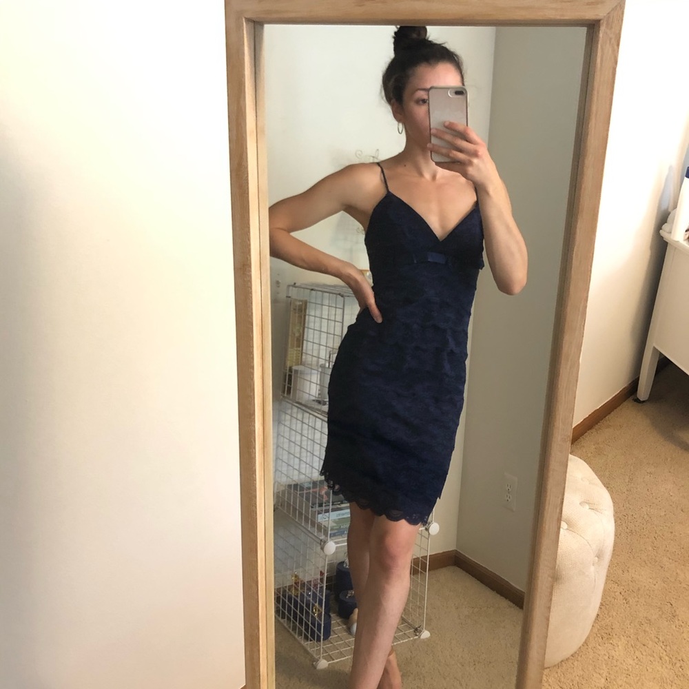 Scalloped Lace Dress